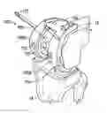 Fig. 01 - Associated instruments and methods for posterior stabilized knee preparation