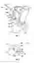 Fig. 02 - Associated instruments and methods for posterior stabilized knee preparation