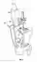 Fig. 04 - Associated instruments and methods for posterior stabilized knee preparation
