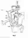 Fig. 05 - Associated instruments and methods for posterior stabilized knee preparation