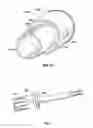 Fig. 07 - Associated instruments and methods for posterior stabilized knee preparation