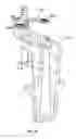 Fig. 09 - Associated instruments and methods for posterior stabilized knee preparation