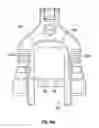 Fig. 10 - Associated instruments and methods for posterior stabilized knee preparation