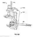 Fig. 12 - Associated instruments and methods for posterior stabilized knee preparation