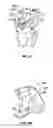 Fig. 17 - Associated instruments and methods for posterior stabilized knee preparation