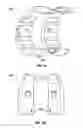 Fig. 19 - Associated instruments and methods for posterior stabilized knee preparation