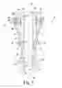Fig. 04 - Surgical instruments and method of surgically preparing a patient's tibia