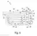 Fig. 06 - Surgical instruments and method of surgically preparing a patient's tibia