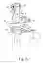 Fig. 29 - Surgical instruments and method of surgically preparing a patient's tibia