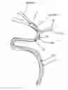 Fig. 01 - Systems and methods to improve perfusion pressure during endovascular intervention