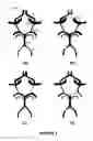 Fig. 03 - Systems and methods to improve perfusion pressure during endovascular intervention