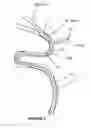 Fig. 06 - Systems and methods to improve perfusion pressure during endovascular intervention
