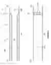 Fig. 07 - Systems and methods to improve perfusion pressure during endovascular intervention