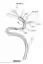 Fig. 08 - Systems and methods to improve perfusion pressure during endovascular intervention