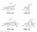 Fig. 02 - Embolectomy devices and methods for treatment of acute ischemic stroke condition