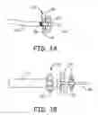 Fig. 04 - Embolectomy devices and methods for treatment of acute ischemic stroke condition