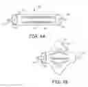 Fig. 05 - Embolectomy devices and methods for treatment of acute ischemic stroke condition