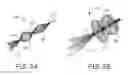 Fig. 06 - Embolectomy devices and methods for treatment of acute ischemic stroke condition