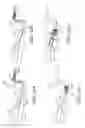 Fig. 12 - Embolectomy devices and methods for treatment of acute ischemic stroke condition