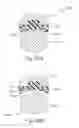 Fig. 25 - END EFFECTOR FOR INSTRUMENT WITH ULTRASONIC AND ELECTROSURGICAL FEATURES
