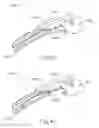 Fig. 27 - END EFFECTOR FOR INSTRUMENT WITH ULTRASONIC AND ELECTROSURGICAL FEATURES