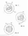 Fig. 06 - Blunt tip obturator