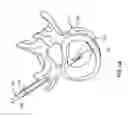 Fig. 07 - Delivery Device and Method For Vertebroplasty and Kyphoplasty Procedures