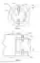 Fig. 08 - Orthopedic anchoring methods