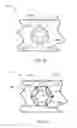 Fig. 09 - Orthopedic anchoring methods