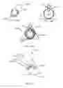 Fig. 12 - Orthopedic anchoring methods