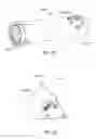 Fig. 15 - Orthopedic anchoring methods