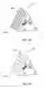Fig. 16 - Orthopedic anchoring methods