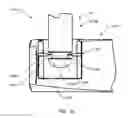 Fig. 21 - Orthopedic anchoring methods
