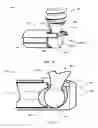 Fig. 22 - Orthopedic anchoring methods