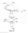 Fig. 35 - Orthopedic anchoring methods