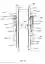 Fig. 38 - Orthopedic anchoring methods