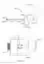Fig. 42 - Orthopedic anchoring methods