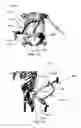 Fig. 49 - Orthopedic anchoring methods