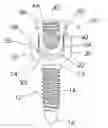 Fig. 01 - Pedicle screw assembly