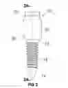 Fig. 03 - Pedicle screw assembly