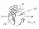 Fig. 09 - Pedicle screw assembly