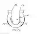 Fig. 11 - Pedicle screw assembly