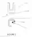 Fig. 03 - Percutaneous pedicle screw revision system