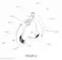 Fig. 07 - Percutaneous pedicle screw revision system