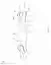 Fig. 15 - Rib hook devices, systems, and methods of use