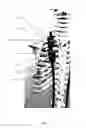 Fig. 23 - Rib hook devices, systems, and methods of use