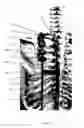 Fig. 24 - Rib hook devices, systems, and methods of use