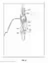 Fig. 10 - Systems and methods for percutaneous spinal fusion