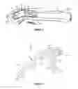Fig. 06 - Bone fixation devices and methods