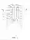 Fig. 03 - Sternum fixation device and method